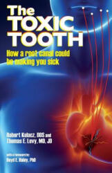 The Toxic Tooth - DDS Robert Kulacz, MD JD Levy (ISBN: 9780983772828)