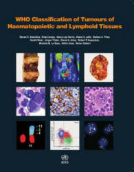 WHO classification of tumours of haematopoietic and lymphoid tissues - S. Swerdlow, E. Campo, N. L. Harris (ISBN: 9789283244943)