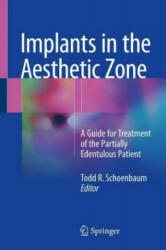 Implants in the Aesthetic Zone: A Guide for Treatment of the Partially Edentulous Patient (ISBN: 9783319726007)