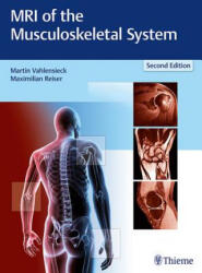 MRI of the Musculoskeletal System - Martin Vahlensieck, Maximilian Reiser (ISBN: 9783131165725)