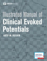 Illustrated Manual of Clinical Evoked Potentials (ISBN: 9781933864723)