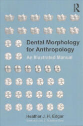 Dental Morphology for Anthropology - Heather J. H. Edgar (ISBN: 9781629585123)