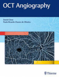 OCT Angiography - David R. Chow (ISBN: 9781626234734)
