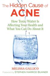 Hidden Cause of Acne - Melissa Gallico, Stephen Harrod Buhner (ISBN: 9781620557099)
