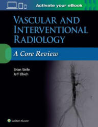 Vascular and Interventional Radiology: A Core Review - Strife, Brian, MD, Jeffrey Elbich (ISBN: 9781496384393)