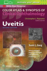 Uveitis - Sunir J. Garg (ISBN: 9781496363008)