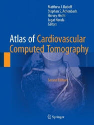 Atlas of Cardiovascular Computed Tomography - Matthew J. Budoff, Stephan S. Achenbach, Harvey S. Hecht, Jagat Narula (ISBN: 9781447173564)