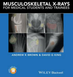 Musculoskeletal X-rays for Medical Students - Andrew K Brown (ISBN: 9781118458730)
