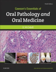 Cawson's Essentials of Oral Pathology and Oral Medicine - EDWARD W. ODELL (ISBN: 9780702049828)