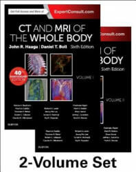 CT and MRI of the Whole Body, 2-Volume Set - John R. Haaga, Daniel Boll (ISBN: 9780323113281)