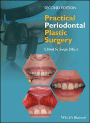Practical Periodontal Plastic Surgery (ISBN: 9781118360651)