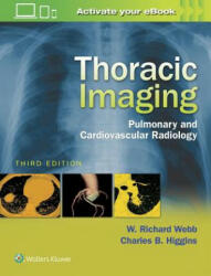 Thoracic Imaging - Robert Webb (ISBN: 9781496321046)