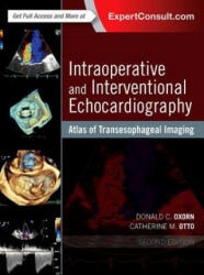 Intraoperative and Interventional Echocardiography - Donald Oxorn, Catherine M. Otto (ISBN: 9780323358255)