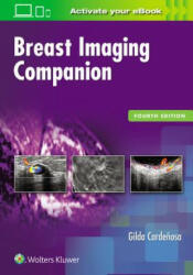 Breast Imaging Companion - Gilda Cardenosa (ISBN: 9781496314963)