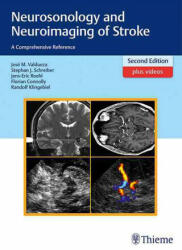 Neurosonology and Neuroimaging of Stroke - José Manuel Valdueza, Stephan Schreiber, Jens-Eric Röhl, Florian Connolly, Randolf Klingebiel (ISBN: 9783131418722)