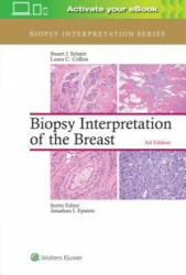 Biopsy Interpretation of the Breast - Stuart J Schnitt (ISBN: 9781496365750)