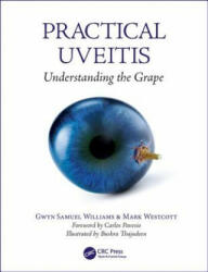 Practical Uveitis - Williams, Gwyn, (ISBN: 9781138035751)