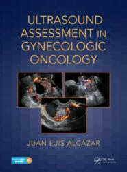 Ultrasound Assessment in Gynecologic Oncology - Alcazar, Juan Luis (Full Professor of Obstetrics and Gynecology, School of Medicine, University of Navarra, Pamplona, SpainAvenida Pio XII 36, Pamplon (ISBN: 9781138044326)