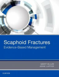 Scaphoid Fractures - Geert Buijze, Jesse B. Jupiter (ISBN: 9780323485647)