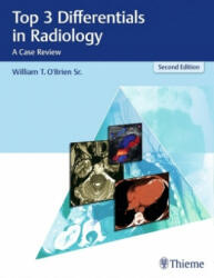 Top 3 Differentials in Radiology - William T. O'Brien (ISBN: 9781626232785)
