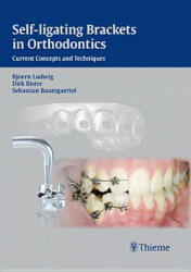 Self-ligating Brackets in Orthodontics - B Ludwig (2011)