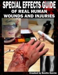 Special Effects Guide Of Real Human Wounds and Injuries: Special Effects Guide Of Real Human Wounds and Injuries - Mr Benito Garcia III (2018)