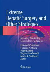 Extreme Hepatic Surgery and Other Strategies: Increasing Resectability in Colorectal Liver Metastases (ISBN: 9783319138954)