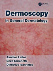 Dermoscopy in General Dermatology (ISBN: 9781138706569)
