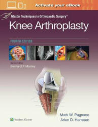 Master Techniques in Orthopedic Surgery: Knee Arthroplasty - Mark W. Pagnano (ISBN: 9781496315052)
