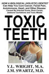 Toxic Teeth: How a Biological (Holistic) Dentist Can Help You Cure Cancer, Facial Pain, Autoimmune, Heart, and Other Disease Caused By Infected Gums, - Y. L. Wright M. A. , J. M. Swartz M. D (ISBN: 9781365316388)