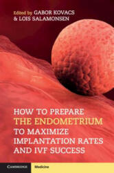 How to Prepare the Endometrium to Maximize Implantation Rates and IVF Success - Gabor Kovacs, Lois Salamonsen (ISBN: 9781108402811)