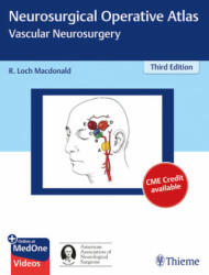 Neurosurgical Operative Atlas: Vascular Neurosurgery - R. Loch Macdonald (ISBN: 9781626231108)