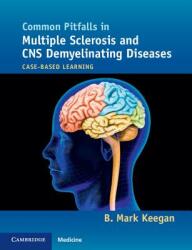 Common Pitfalls in Multiple Sclerosis and CNS Demyelinating Diseases: Case-Based Learning - B. Mark Keegan (ISBN: 9781107680401)