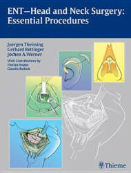 ENT Head and Neck Surgery: Essential Procedures - Jürgen Theissing, Gerhard Rettinger, Jochen Alfred Werner (2010)