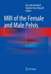 MRI of the Female and Male Pelvis - Riccardo Manfredi, Roberto Pozzi Mucelli (ISBN: 9783319355597)
