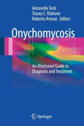 Onychomycosis - Antonella Tosti, Roberto Arenas, Tracey C. Vlahovic (ISBN: 9783319448527)