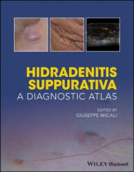Hidradenitis Suppurativa - A Diagnostic Atlas - Giuseppe Micali (ISBN: 9781119272953)