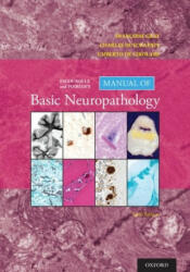 Escourolle and Poirier's Manual of Basic Neuropathology - Francoise Gray, Charles Duyckaerts, Umberto De Girolami (ISBN: 9780190675011)