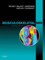 Musculoskeletal MRI - Clyde Helms (2008)