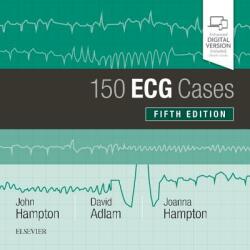 150 ECG Cases - John Hampton, David Adlam, Joanna Hampton (ISBN: 9780702074585)