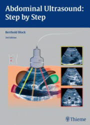 Abdominal Ultrasound: Step by Step - Berthold Block (ISBN: 9783131383631)