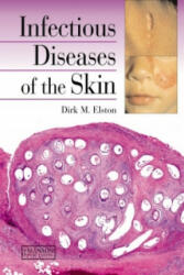 Infectious Diseases of the Skin - Dirk M Elston (2011)