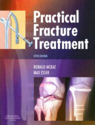 Practical Fracture Treatment - Ronald McRae (2008)