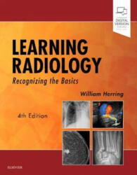Learning Radiology: Recognizing the Basics - William Herring (ISBN: 9780323567299)
