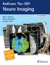 RadCases Plus Q&A Neuro Imaging - Roy Riascos, Eliana Bonfante, Susana Calle (ISBN: 9781626232372)