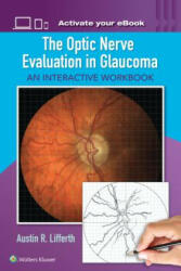 Optic Nerve Evaluation in Glaucoma - Austin Lifferth (ISBN: 9781496363138)