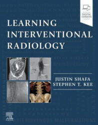 Learning Interventional Radiology - Justin Shafa, Kee, Stephen T, MD (ISBN: 9780323478793)