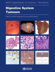 Digestive System Tumours: Who Classification of Tumours - Who Classification of Tumours Editorial (ISBN: 9789283244998)