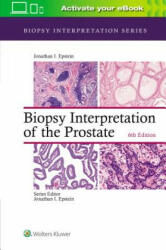 Biopsy Interpretation of the Prostate (ISBN: 9781975136543)
