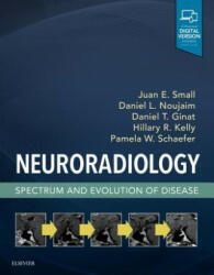 Neuroradiology: Spectrum and Evolution of Disease - Juan Small, Daniel Noujaim, Daniel Thomas Ginat, Kelly, Hillary R, MD, Schaefer, Pamela W, MD (ISBN: 9780323445498)